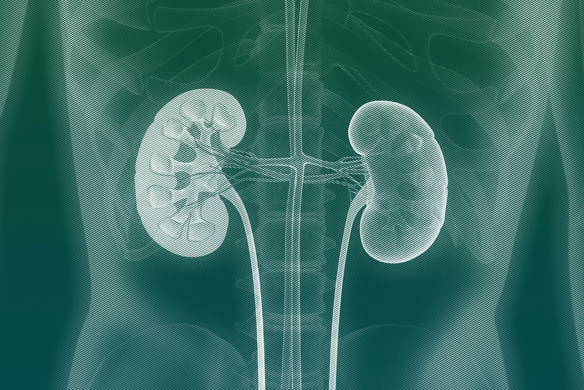 Luminary Labs to support KidneyX